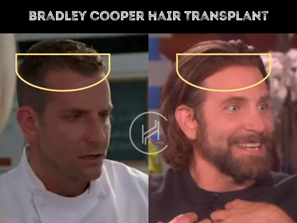 Bradley Cooper Long Hairstyles: How Often Does He Change Them? (All His Looks)