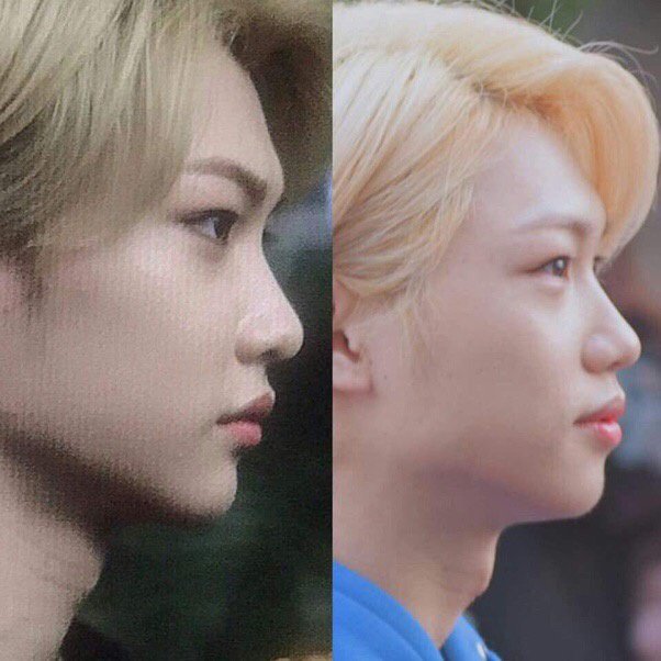 Felix Stray Kids Real Skin: How He Gets His Glowing Complexion