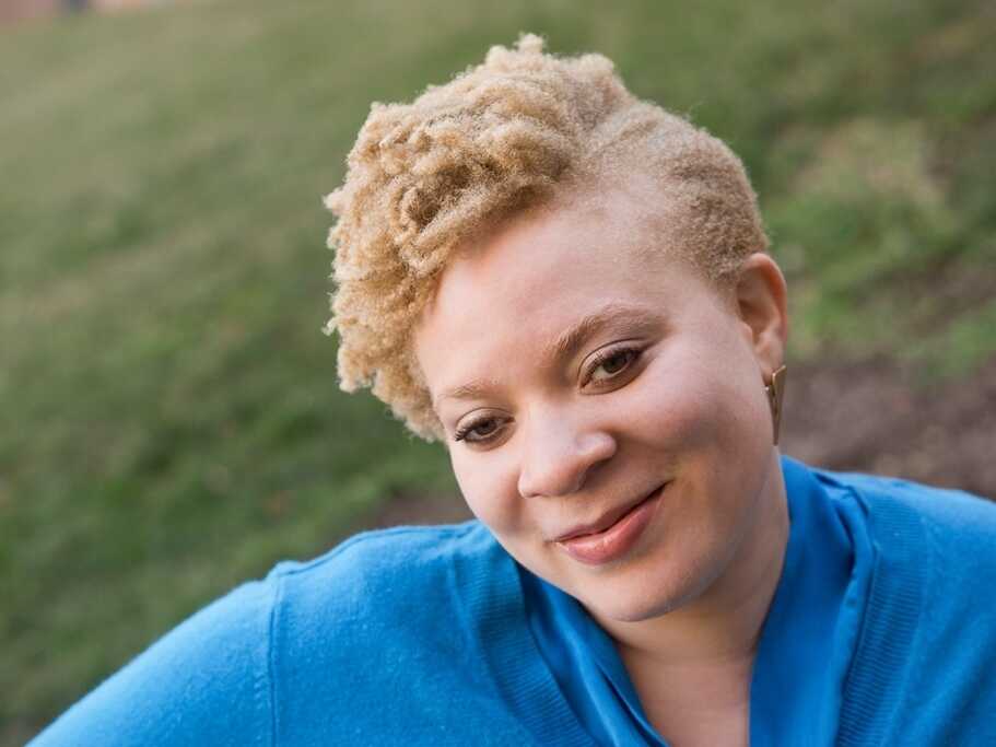 Living as an Afro American Albino: Insights into Their Unique Perspective on Life
