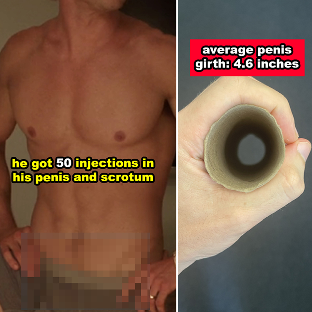 Penis Filler: Does It Really Work (Learn the Truth Here)