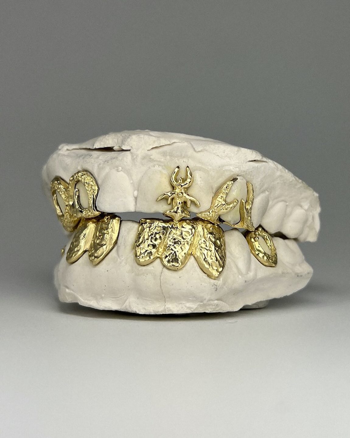 Emma DArcy Grillz: How to Get the Look and Where to Find Them Online Now!