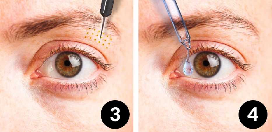 How to make eyelids bigger naturally (easy home remedies that actually work for you)